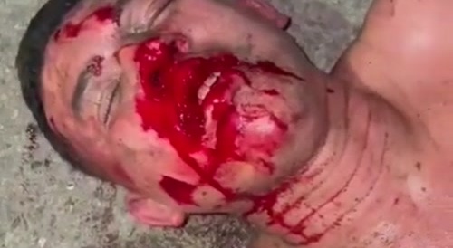 Thief Screams While Being Punished