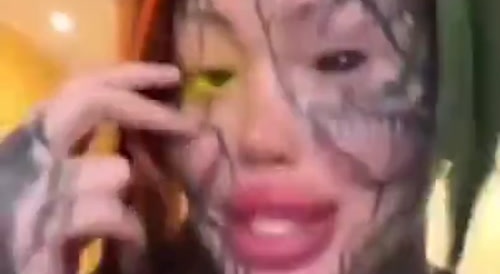 Woman's eye modification gone wrong... !