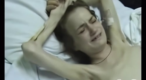 Woman suffers from dark nipples disorder
