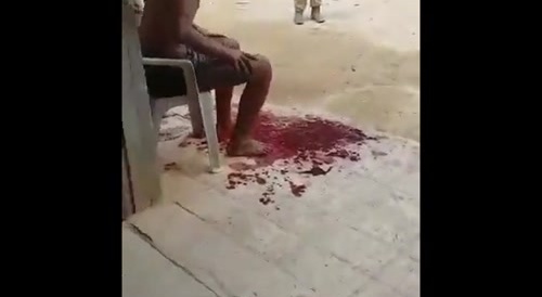Machete Attack, Part 1