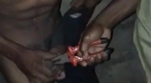 A boy is pinched on his penis with a pair of pliers... !
