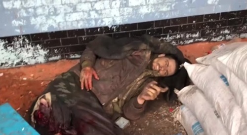 The Ukrainian asks to bring his leg.