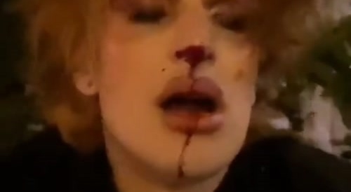 Transgender beaten up in Lviv, capital of Ukrainian nationalism... !