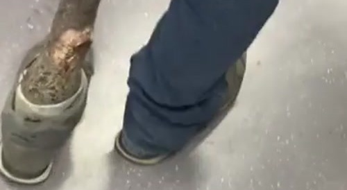 Doctor's waiting room : leg's gonna fall off in a minute...