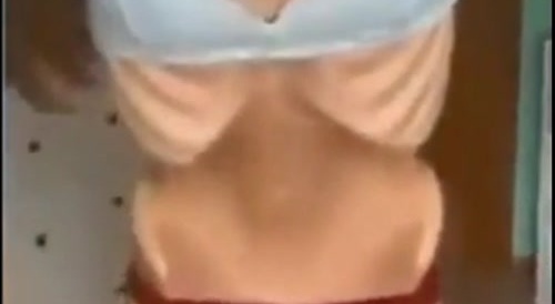 Never seen this degree of anorexia before... !