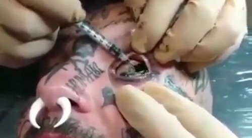 Extreme eye modification : turn it black... !