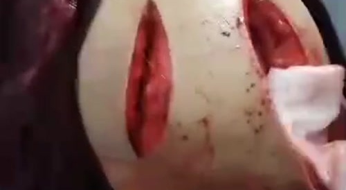 A woman butchered with a machete, still living... !