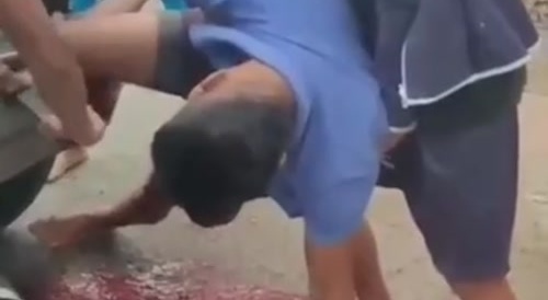 Man's leg caught up in vehicle's front bumper/radiator grille & bleeding profusely...
