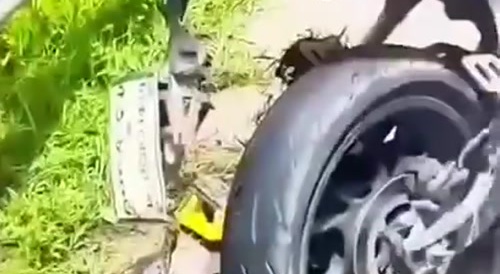 Dude forgot his leg on the highway