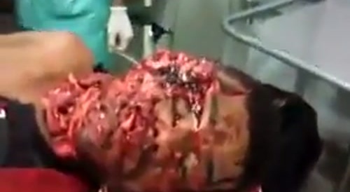 WTF ? Medical staff laughs at man's total fucked up face...!