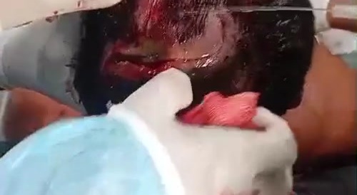 After the jaguar attack