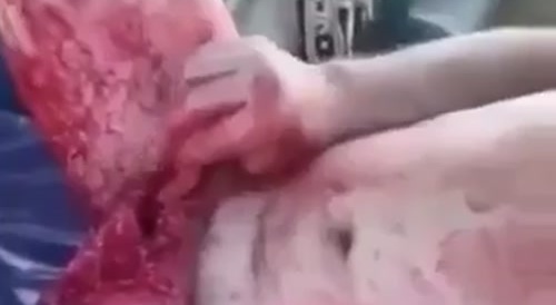 He has cut off his penis : now a big bloody gaping wound... !