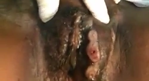 A woman with some nasty pussy disease... !