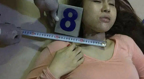 Staged Suicide Gallery