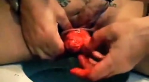 A man is skinning his penis... !