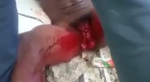 The penis is gone, only the ballsack remains... !