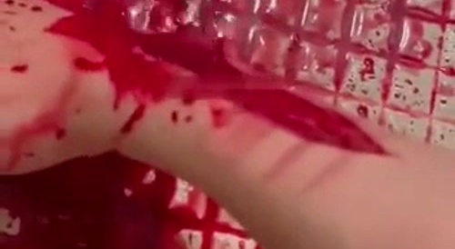 A cascade of blood from a forearm... !