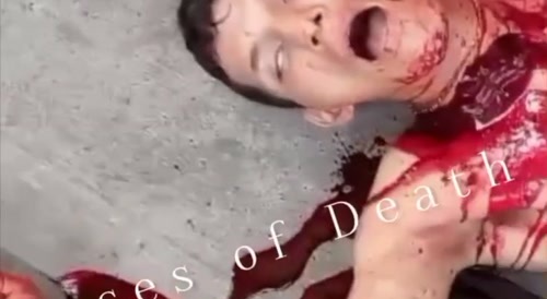 The chap's been slashed & dying... !