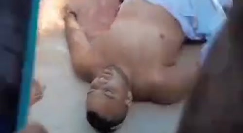 Shark victim : a man's lower body completely mauled... !