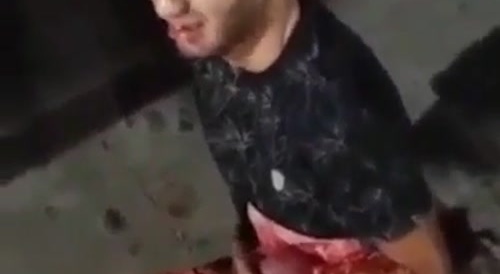 A man barely holding his organs from coming out... !
