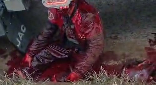 Motorbiker under truck in great pain...