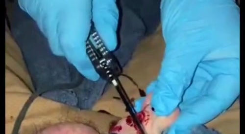 A man lets a masked woman cut off his penis' acorn... !