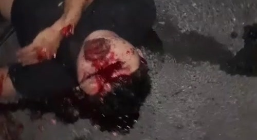 Motorcycles crashed together, multiple victims... !