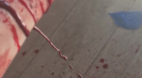 Self-mutilating your arm... !