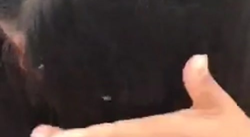 Woman has some bug problem... !