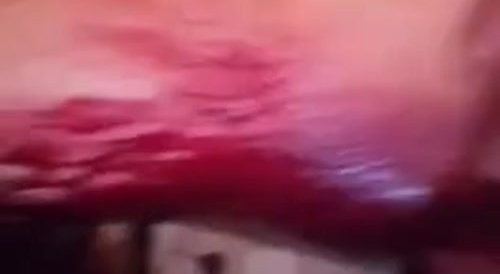 Bleeding mess : mad grandma severs a man's penis with knife... !