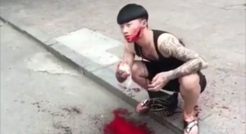 Chink got slashed on his face