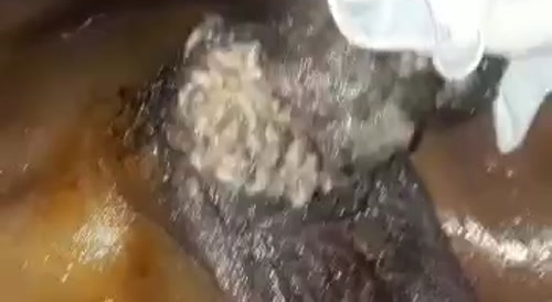 JUICELY & SQUISHYLY : a maggot-infested penis... !