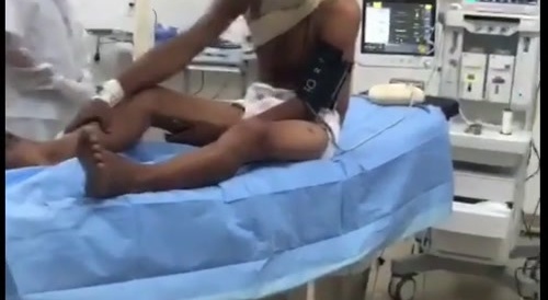 Man Impaled At The Shoulder With Sharp Board