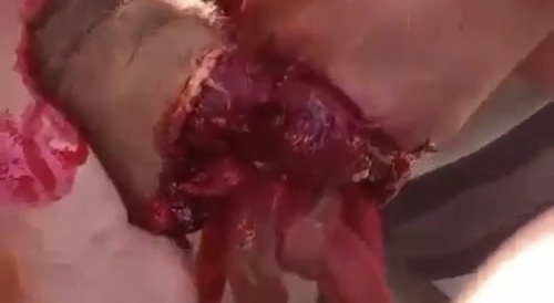 Mans Arm Turns into Yummy Fruit Roll-Up