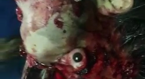 Impaled AND alive... !