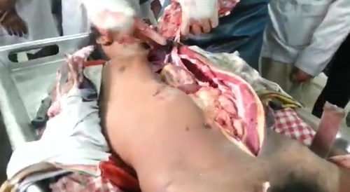 Autopsy, Medical Studies