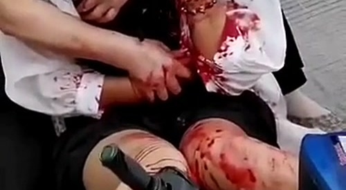 Motorcycle accident : Chinese girl's face split in half... !