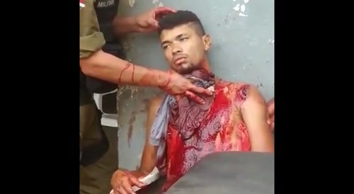 Machete Attack, Part 2