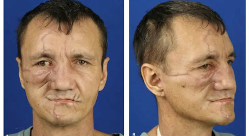 Bear Face Reconstruction Gallery