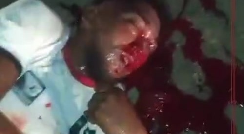 Accident with multiple participants dead or alive... !