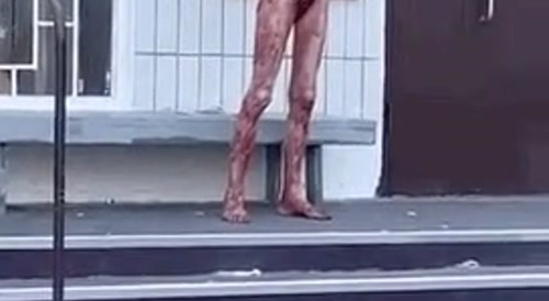 Stabbed himself all over & staring at his own cut off penis... !