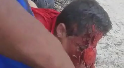 Local punishment in Brazil... !