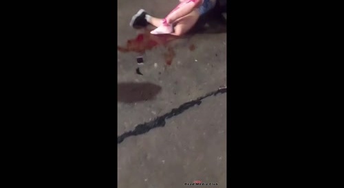 Girl's ankle snapped in traffic accident...
