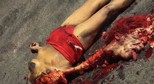 Gruesome aftermath of a collision between a bus and a woman