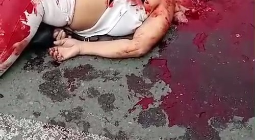 In the truck accident, the man's head was crushed.