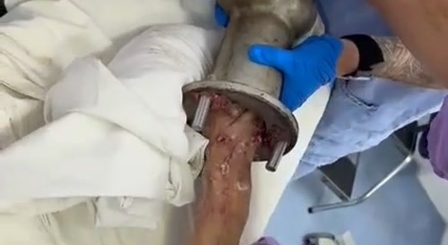 Meat Grinder Extraction