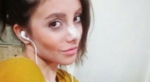 Woman had 50 surgeries to look like Angelina Jolie but the surgery went wrong