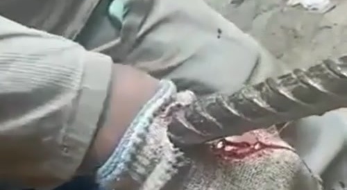 Construction worker got metal tool rod right through the hand... !