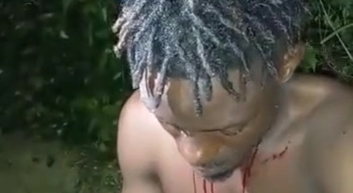Black man is shot in several places...