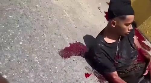 Bloody people in motorbike crash in Venezuela...